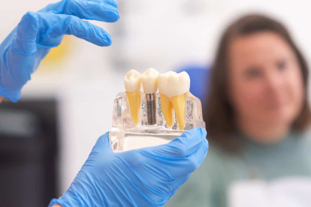 vstavitev zobnega implantanta